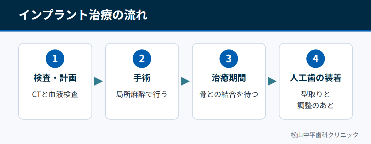 検査と治療計画、インプラントを埋める手術、骨と結合するのを待つ期間、人工歯の装着という治療の流れを示した図